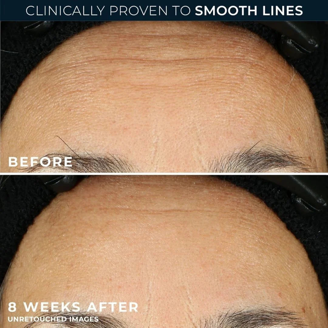 Retinol Correxion Anti-Aging Night Serum Capsules
