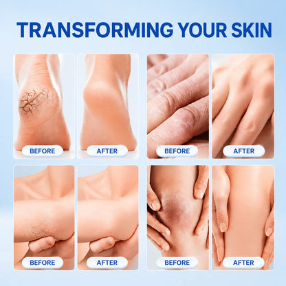 Cracked Skin Repair Cream