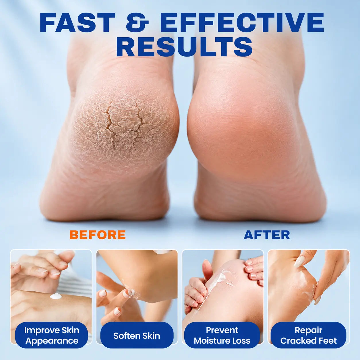 Cracked Skin Repair Cream