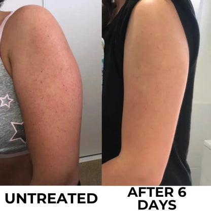Strawberry Skin Resurfacing Cream