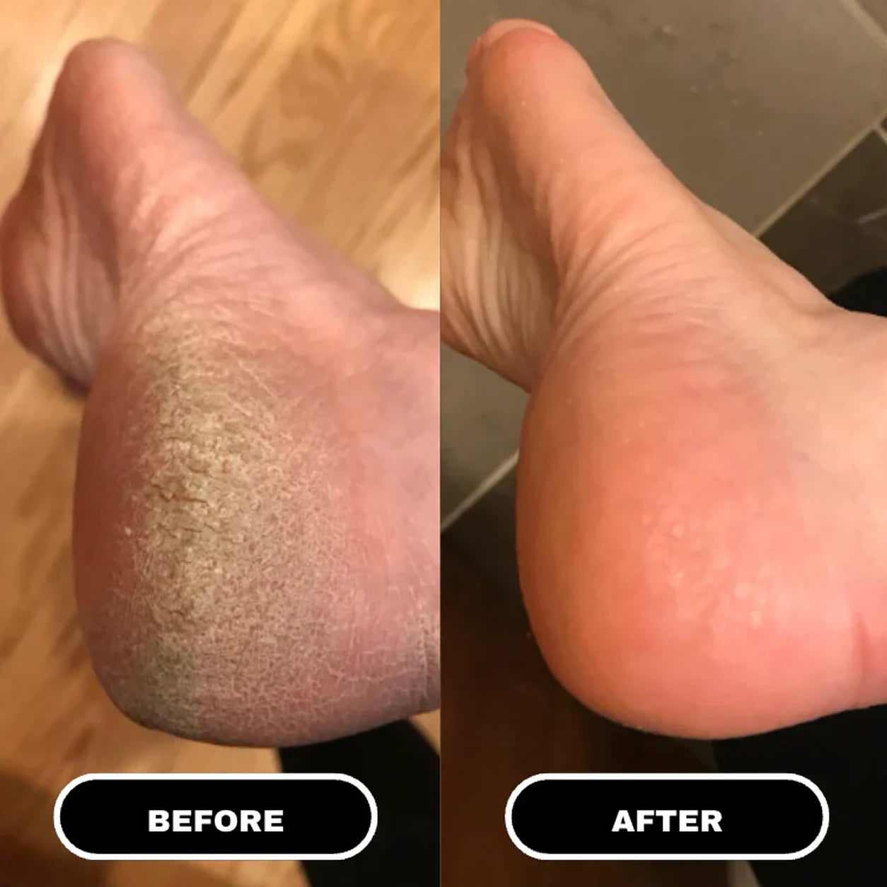 Cracked Skin Repair Cream